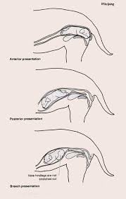 dog labor, retained afterbirth, my dog is in labour, dog labor services in staffordshire, birmingham